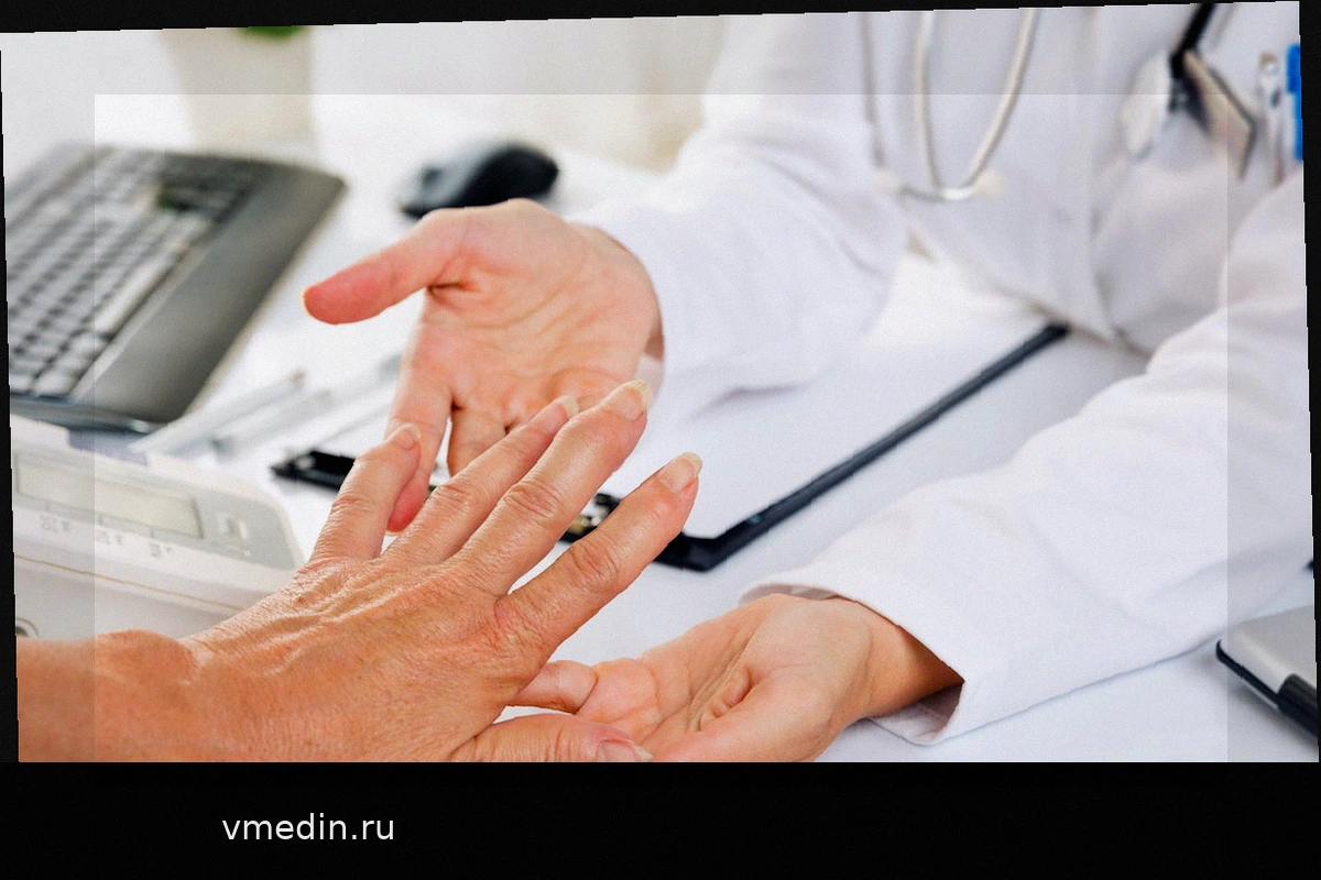 Лечение Чикунгуньи